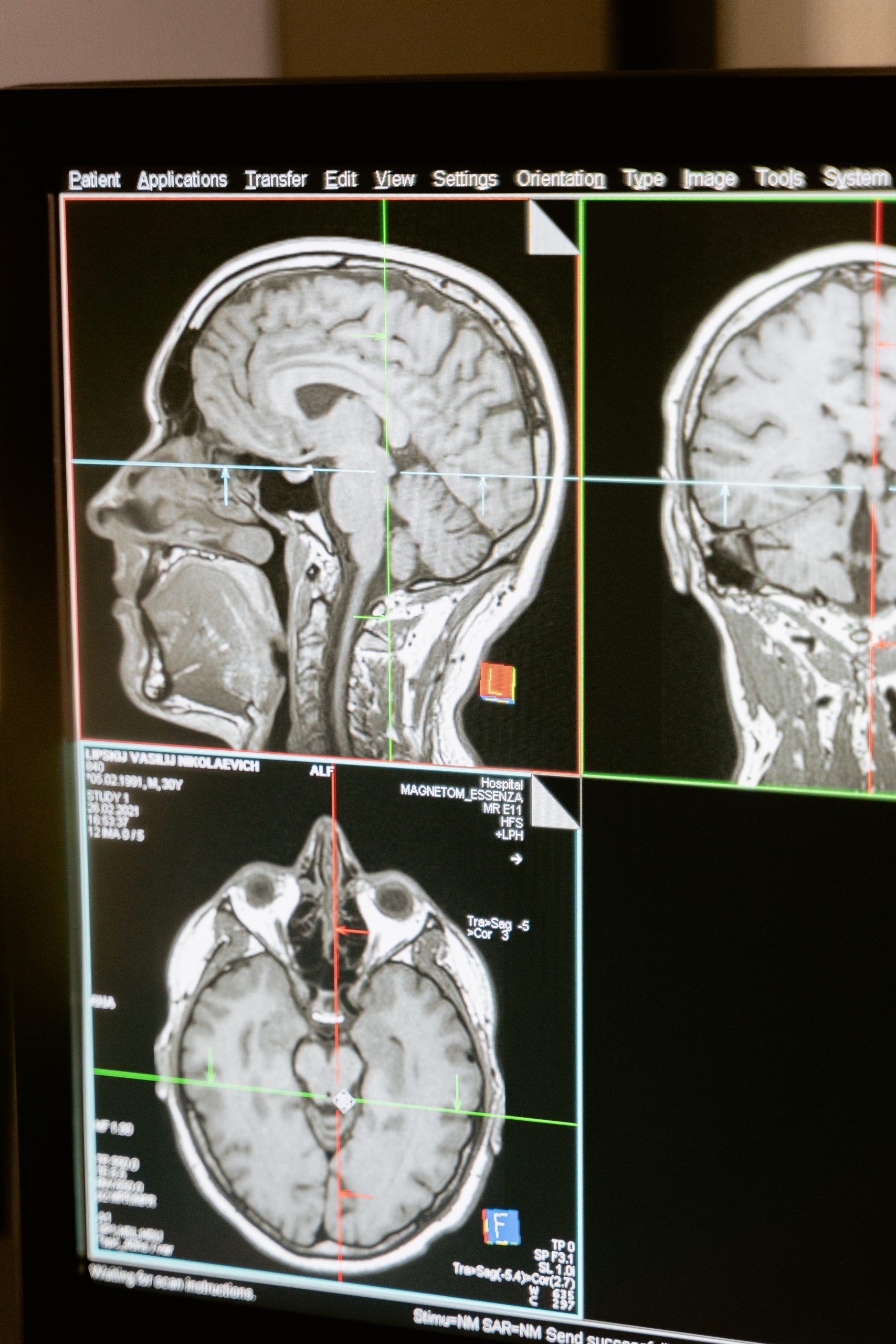 Esc&aacute;ner cerebral