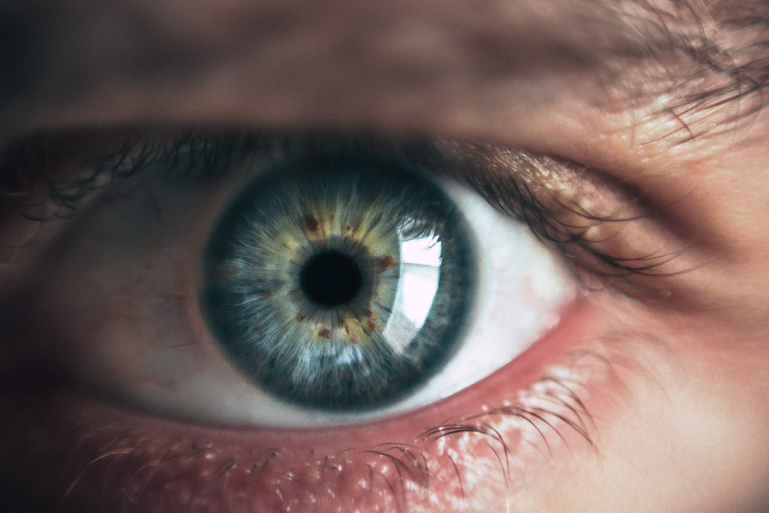 Ojos