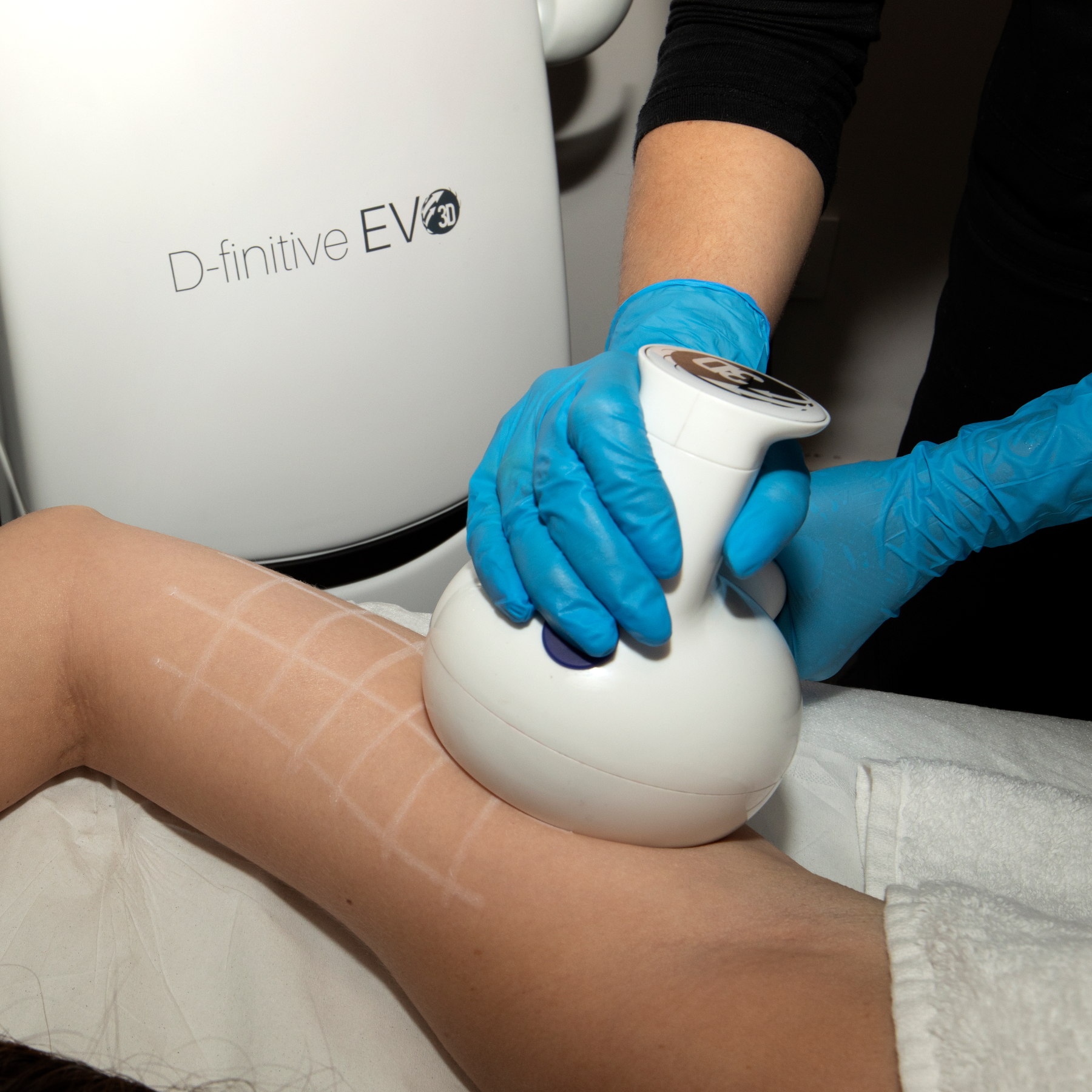 Uno de los tratamientos est&eacute;ticos de Nordetia/Foto: Nordetia Clinics