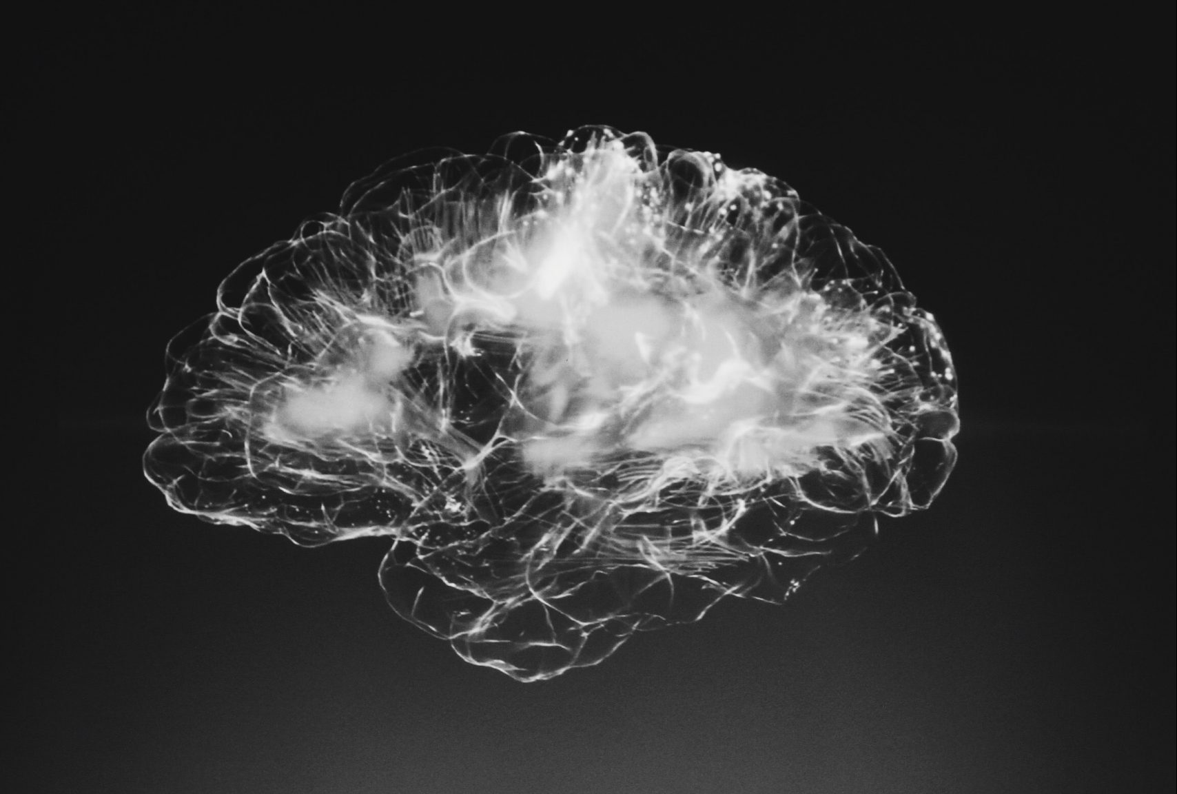 Cerebro