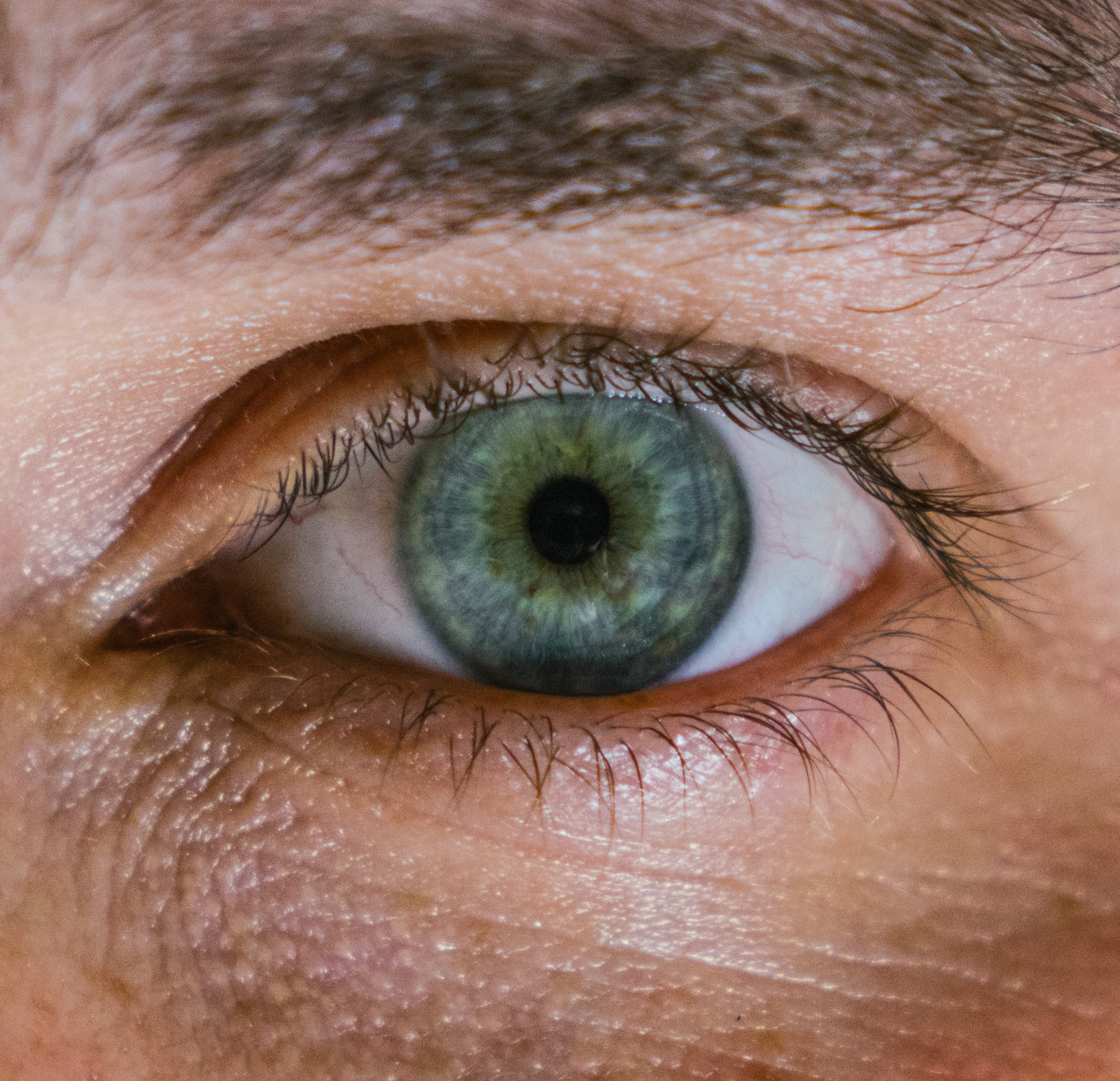 Ojo
