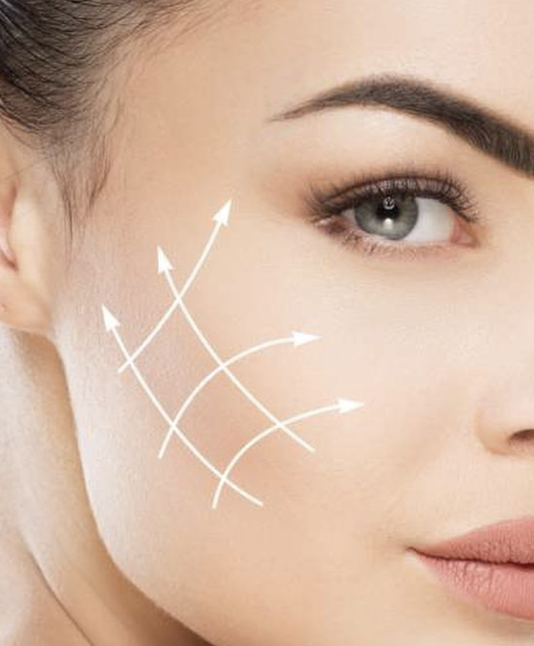 Ultherapy