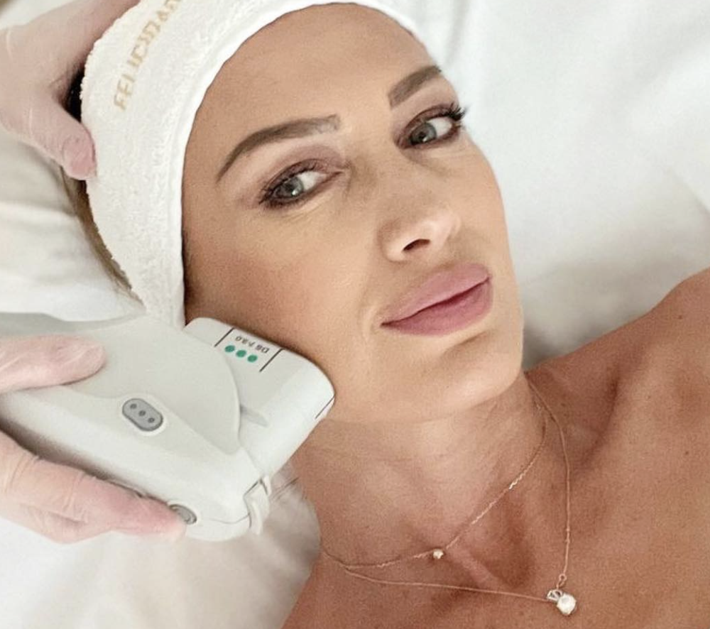 Ultherapy, tratamiento antiedad