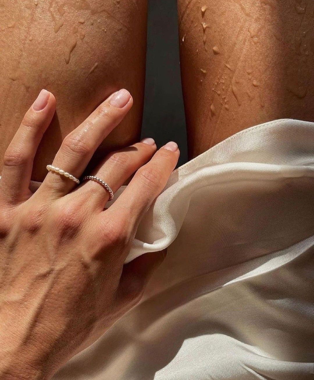 Varices
