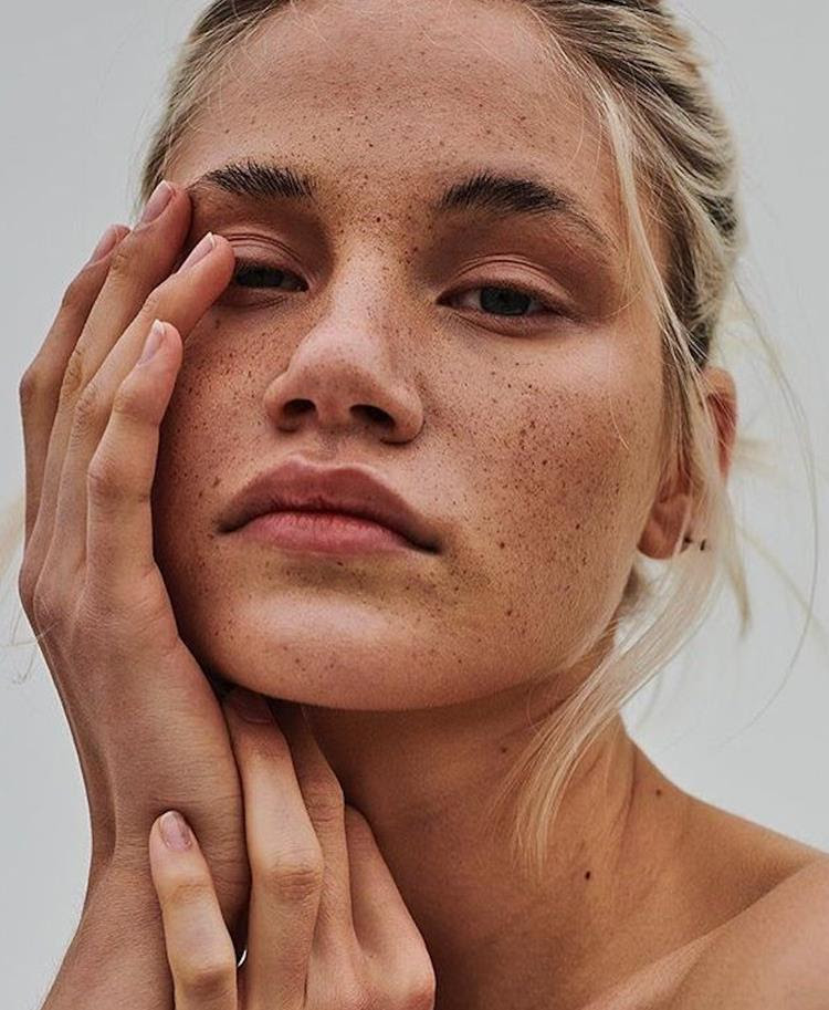 Para prevenir manchas solares en la piel