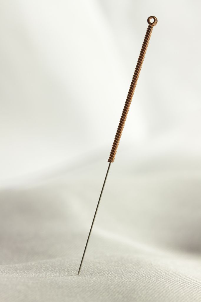 Acupuntura