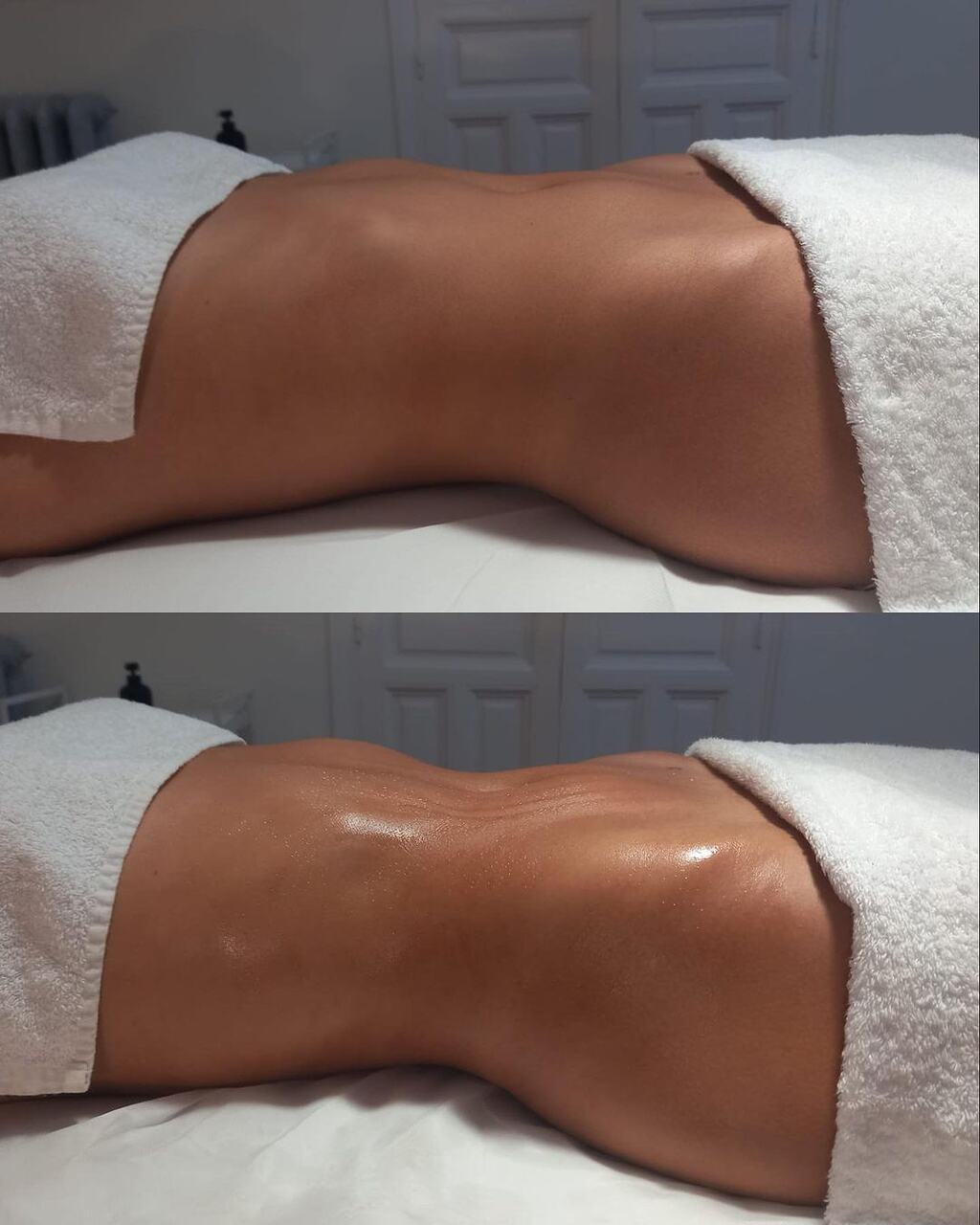 Tratamientos flash, centros est&eacute;tica madrid, remodelaci&oacute;n, tratamientos Navidad