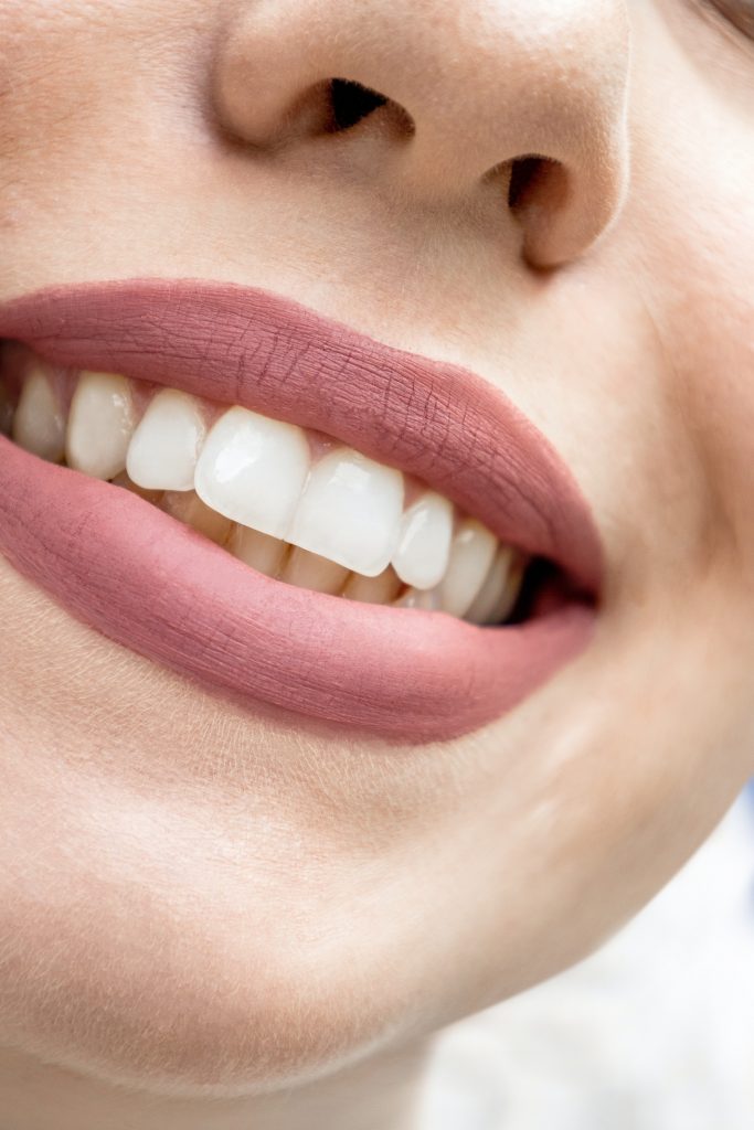 Dentadura bonita limpieza dental SPA