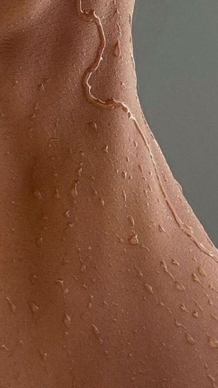 psoriasis causas