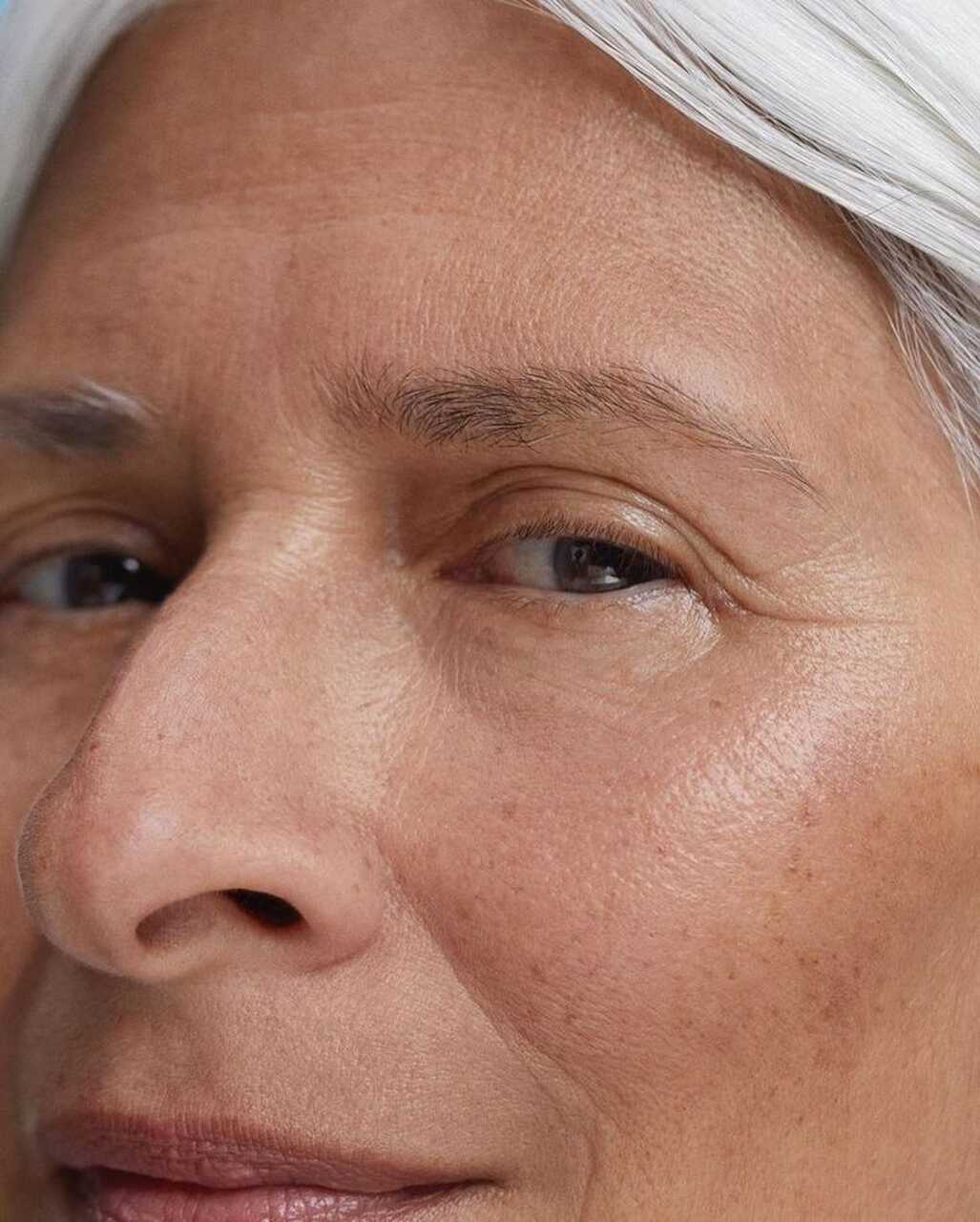consejos dermatologa