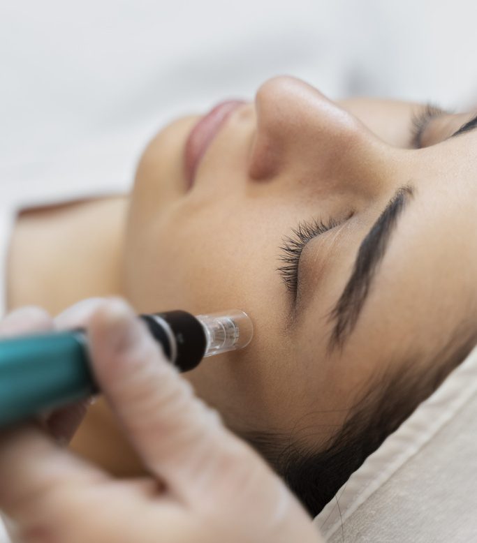 Dermapen, antiedad