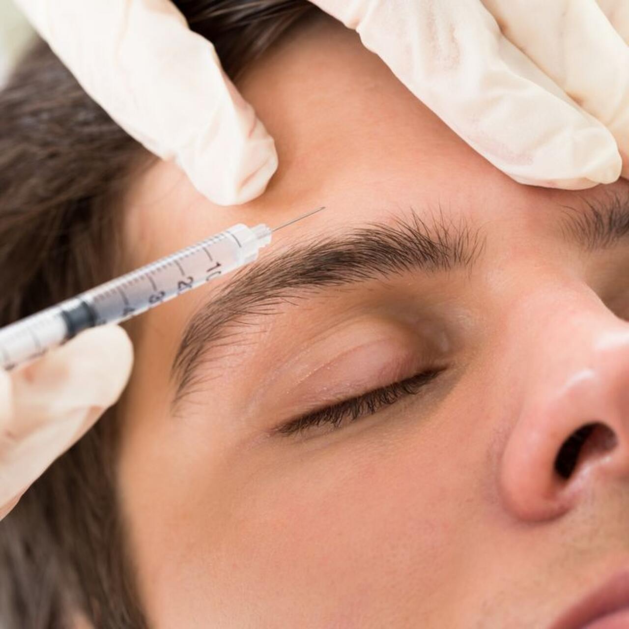 hilos tensores clinicas