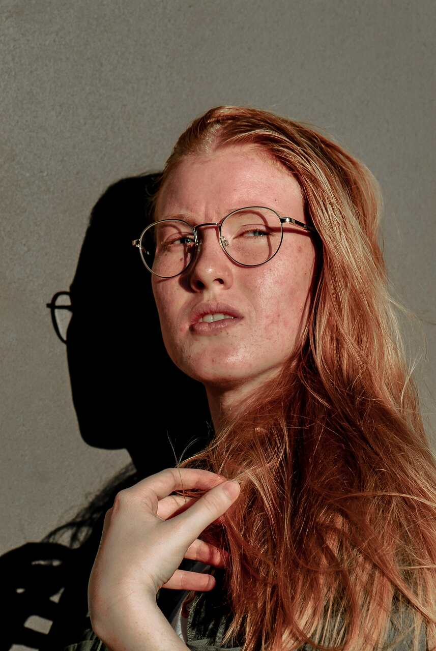 ros&aacute;cea errores