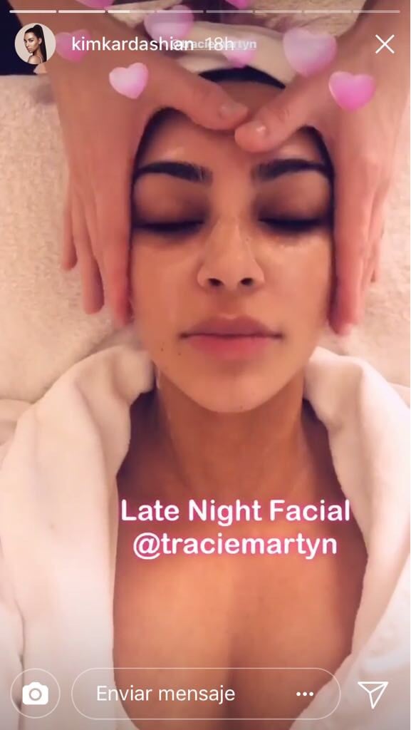 Kim Kardashian tratamiento de belleza 