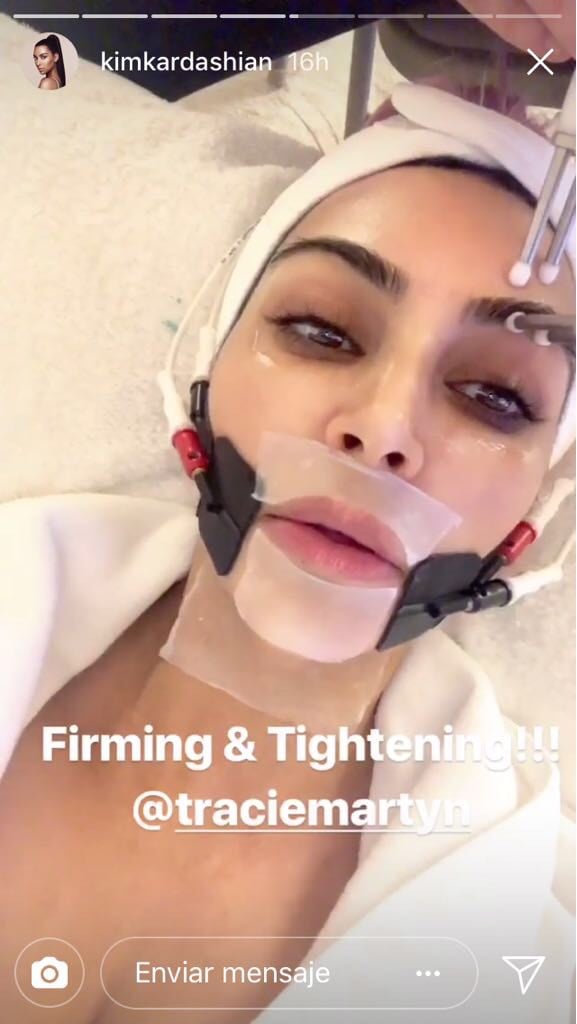 Kim Kardashian tratamiento de belleza 