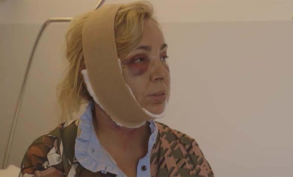 Las primeras imágenes de Carmen Borrego tras su operación de estética/ Telecinco