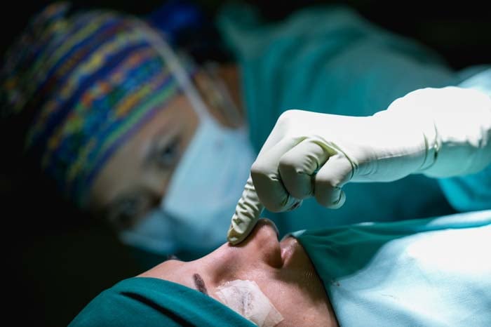Rinoplastia secundaria / Sensabell Plastic Surgery