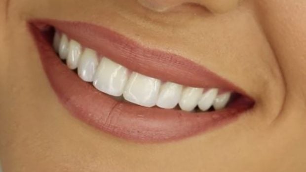 La sonrisa y la autoestima, totalmente relacionadas