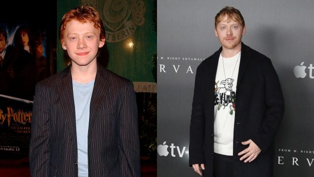 Rupert Grint antes y despu&eacute;s./Gtres
