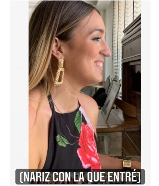 Marta Riesco operada de la nariz/Instagram
