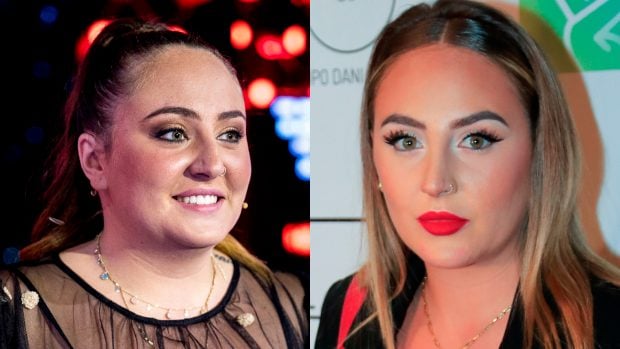 Roc&iacute;o Flores antes y despu&eacute;s de sus retoques est&eacute;ticos./Gtres