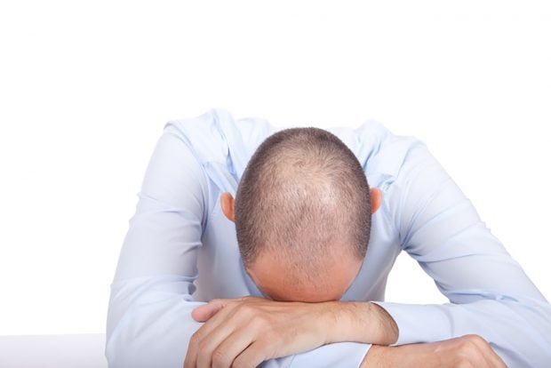 alopecia