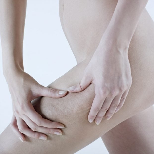 celulitis