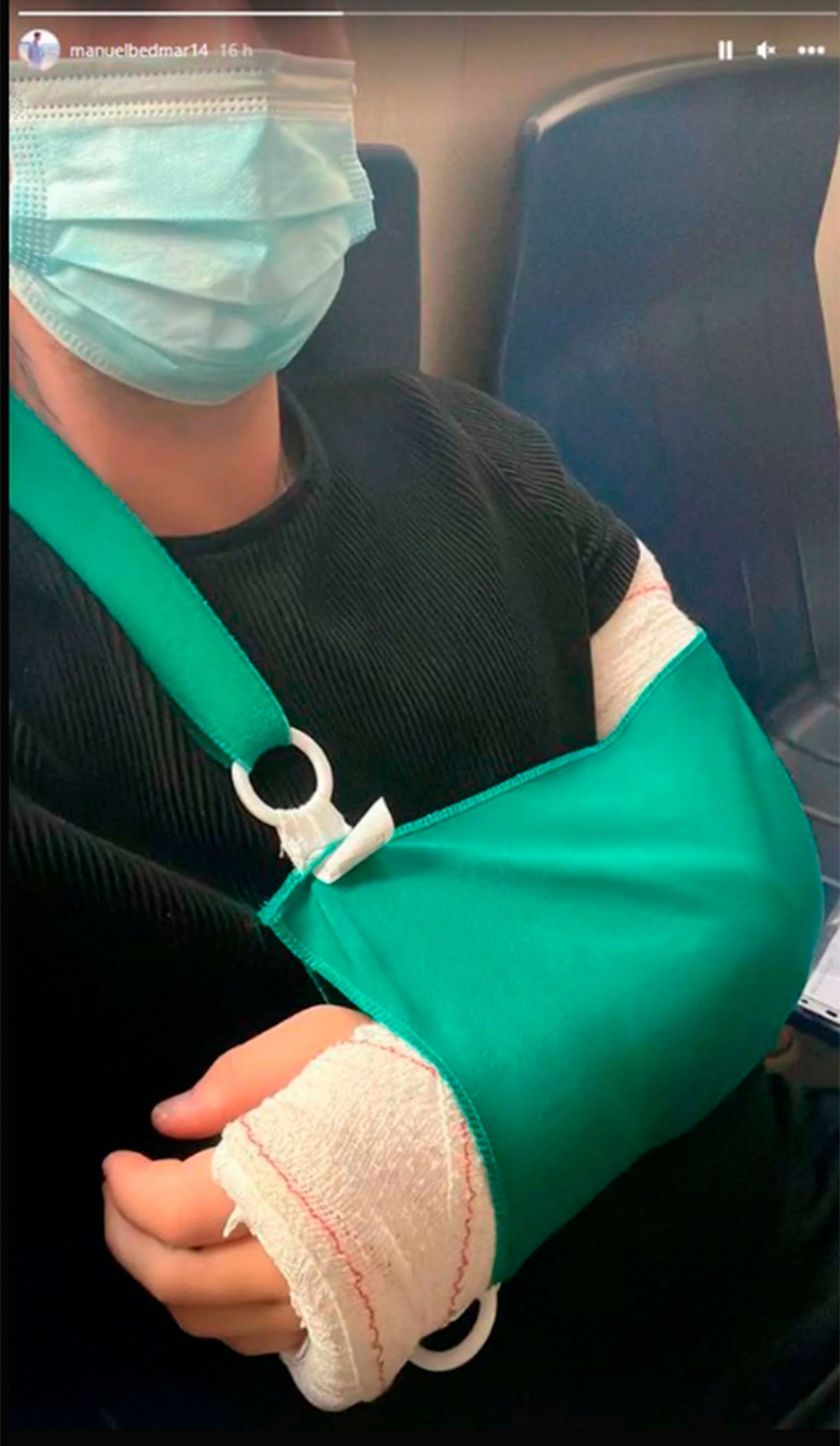Manuel Bedmar, con el brazo escayolado / Instagram