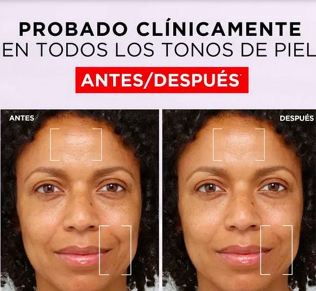 Antes y después de utilizar la crema / Primor