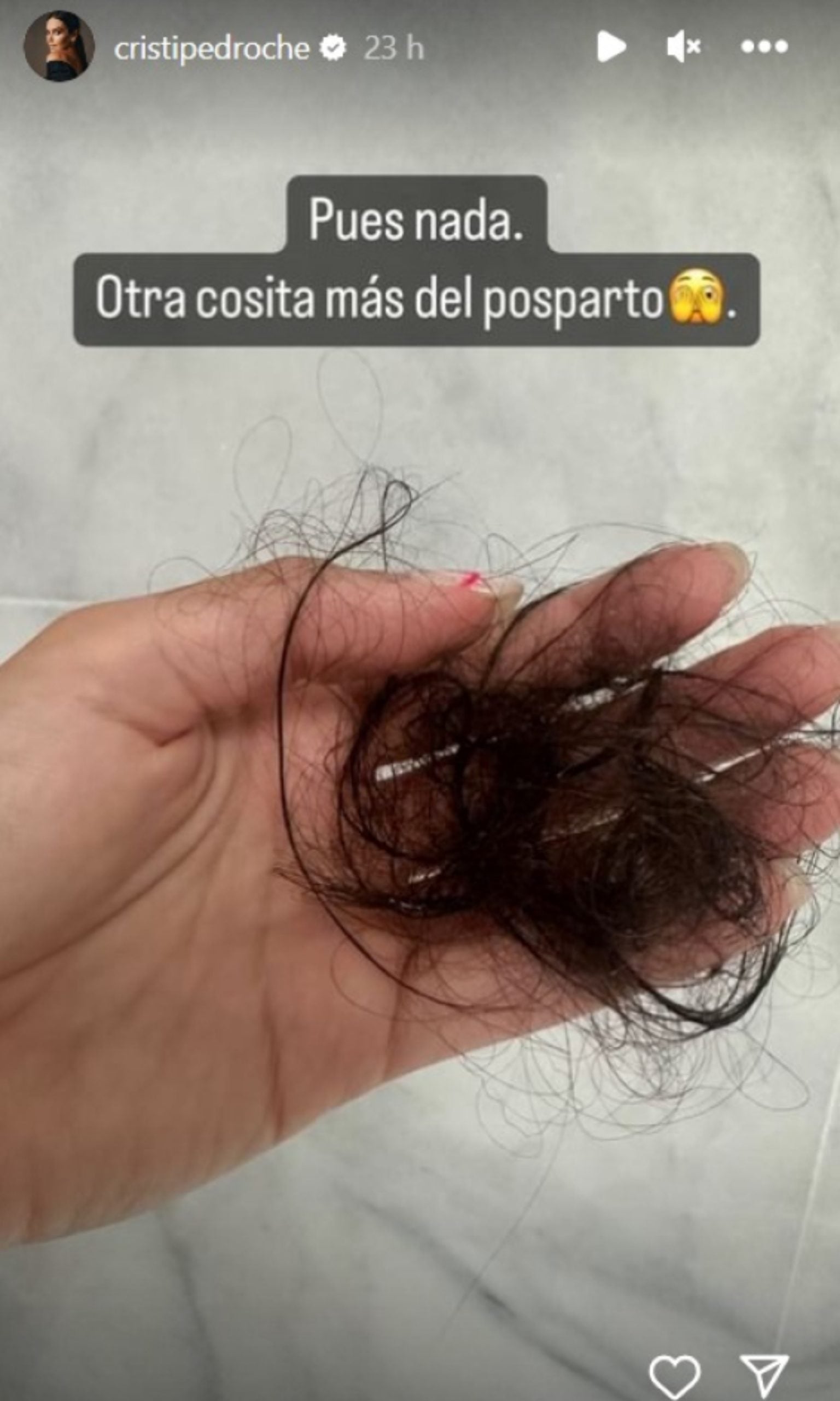 Cristina Pedroche ense&ntilde;a su ca&iacute;da del pelo posparto/ Instagram