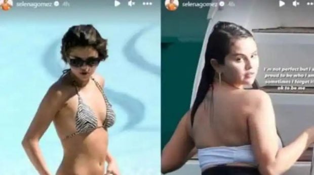 Selena Gómez, Selena Gómez cambio fisico, Selena Gómez problemas, Selena Gómez salud,