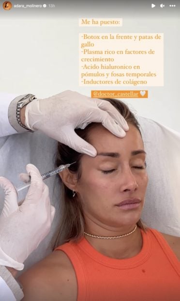 Adara desastres est&eacute;ticos