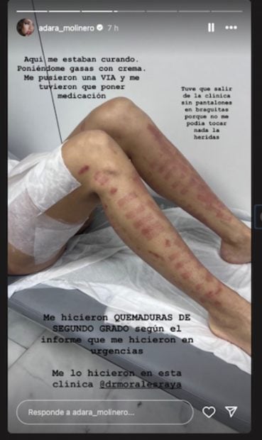 Adara desastres est&eacute;ticos