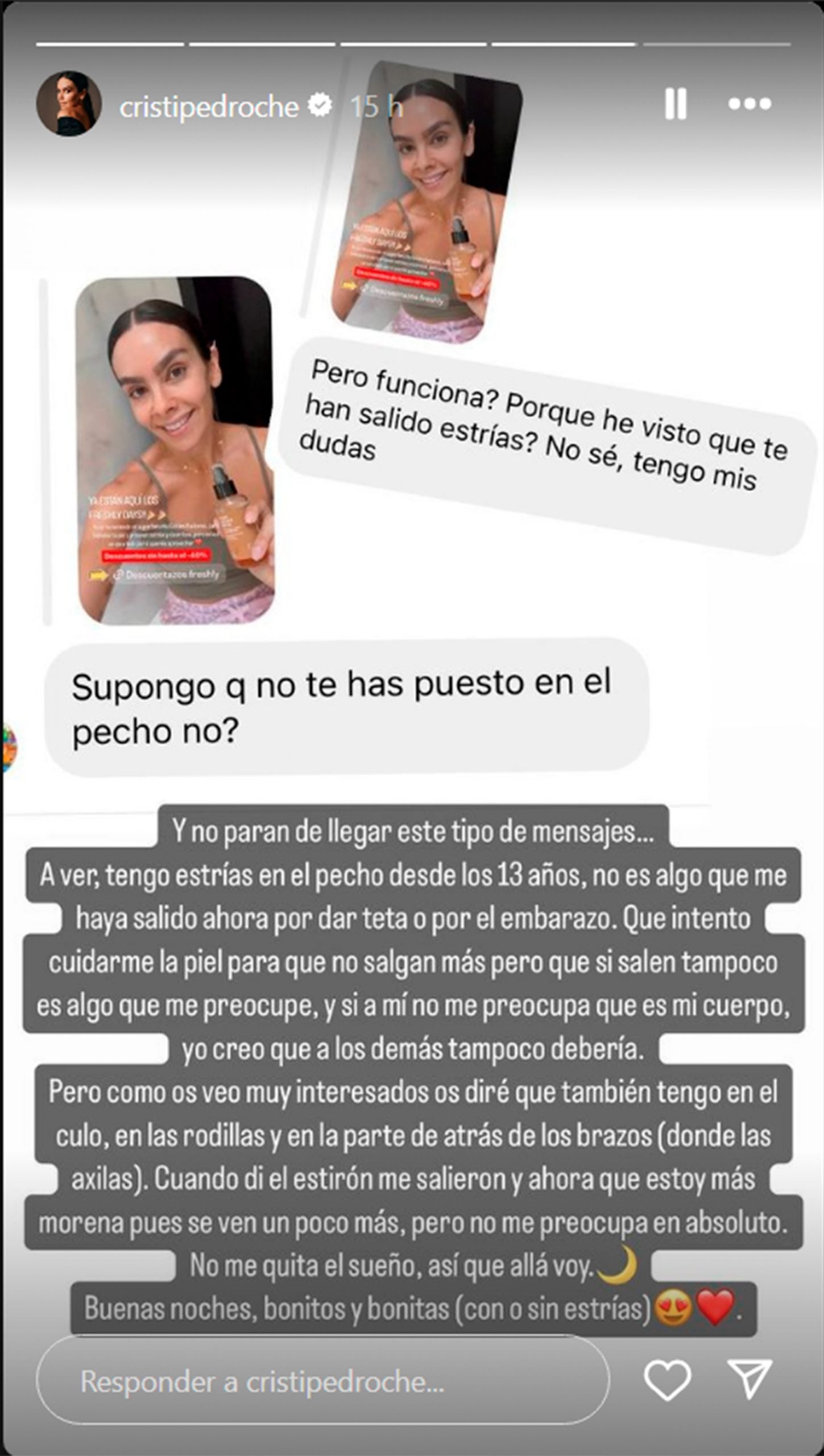 Cristina Pedroche, Pedroche estrias, hija Cristina Pedroche