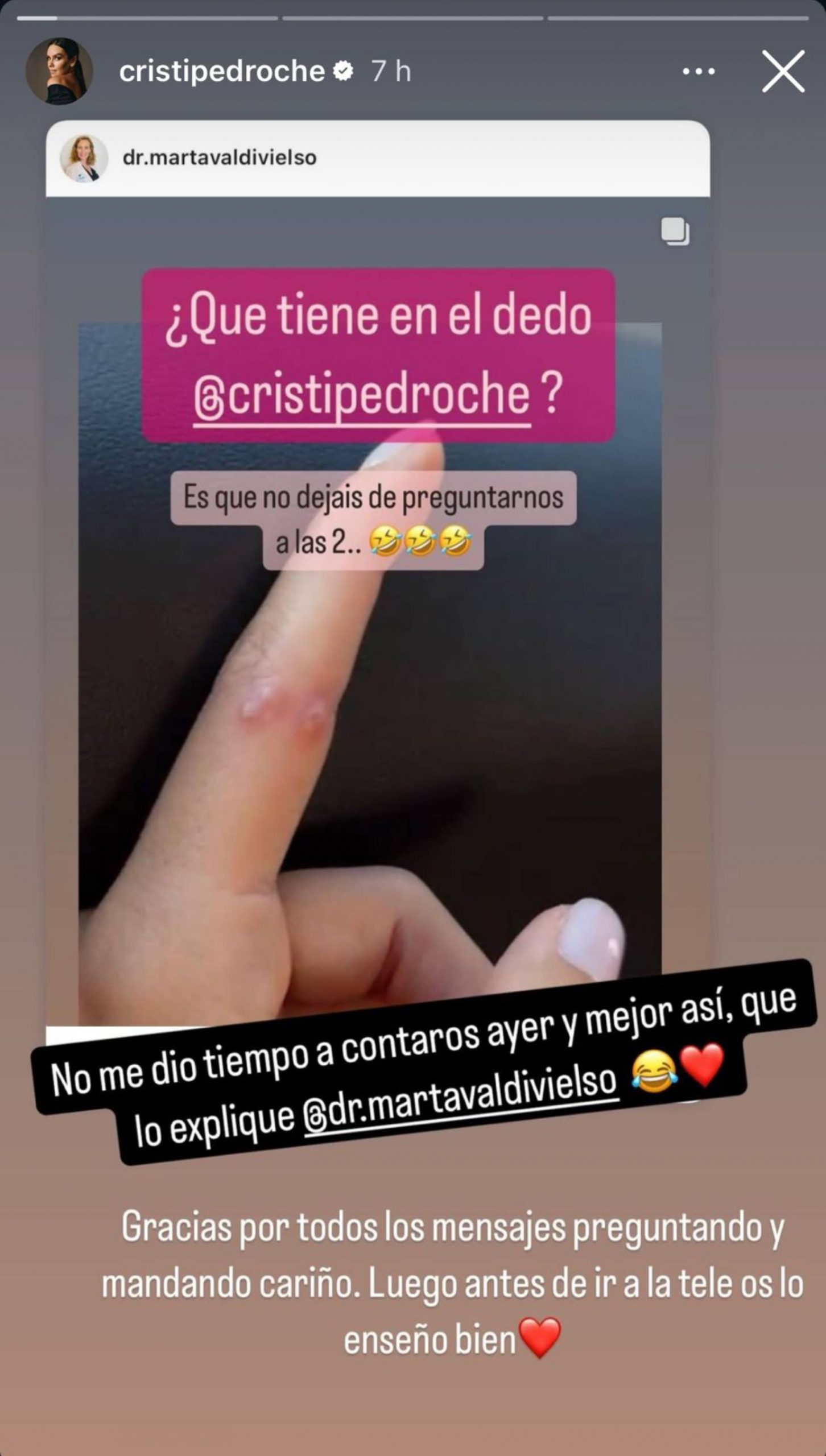 Cristina Pedroche, dedo Cristina Pedroche, Dabiz Mu&ntilde;oz