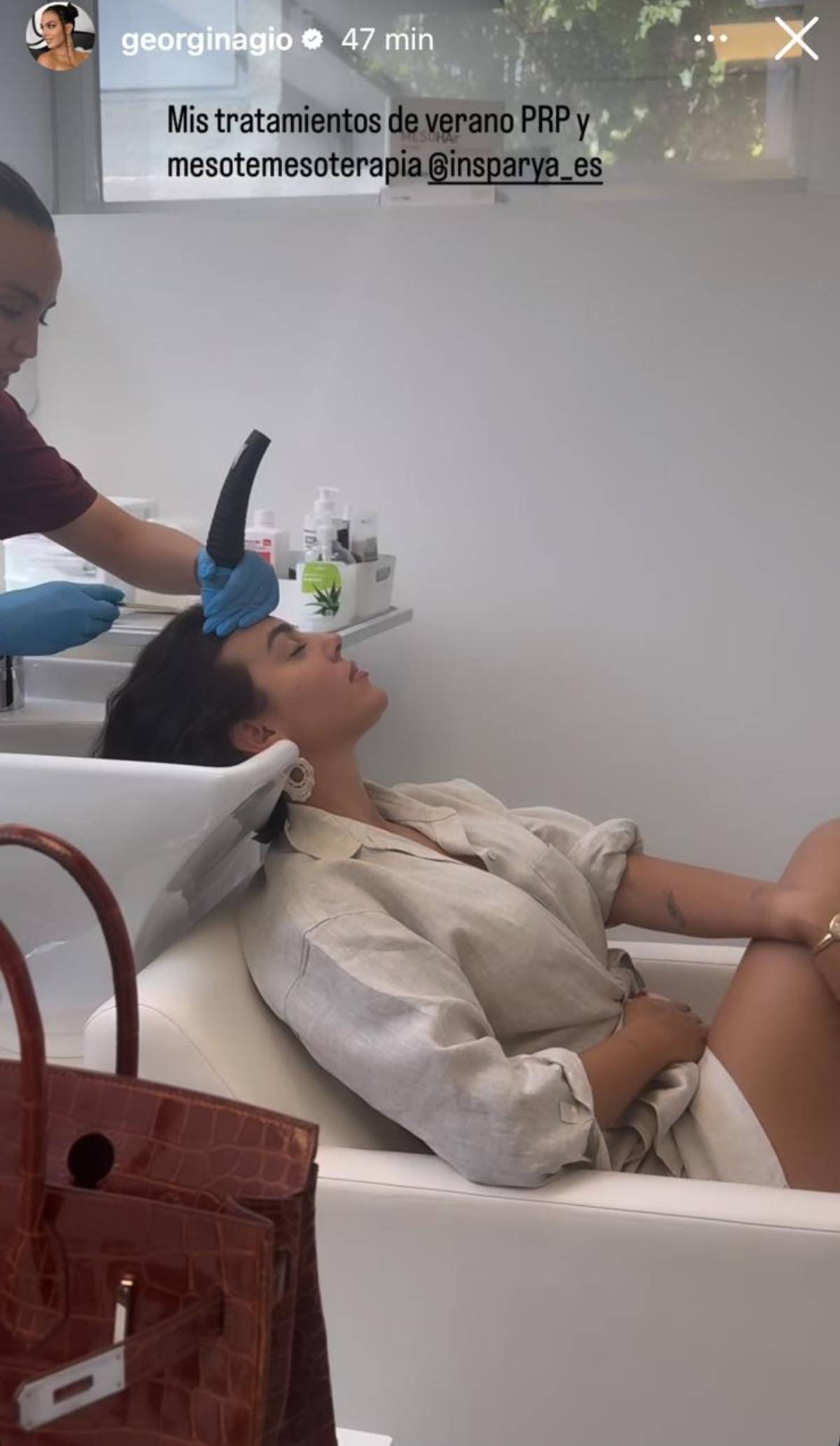 El momento en que 'Gio' recibe un tratamiento estético (PRP y mesoterapia capilar) en una clínica especializada. (Redes Sociales)