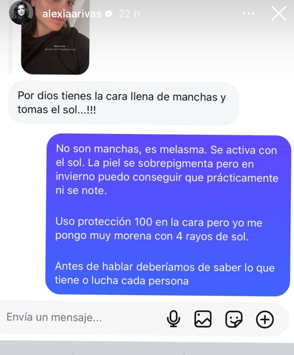 Captura del mensaje ofensivo que recibi&oacute; sobre sus &ldquo;manchas&rdquo; y la respuesta informativa que dio sobre el melasma. (Redes Sociales)