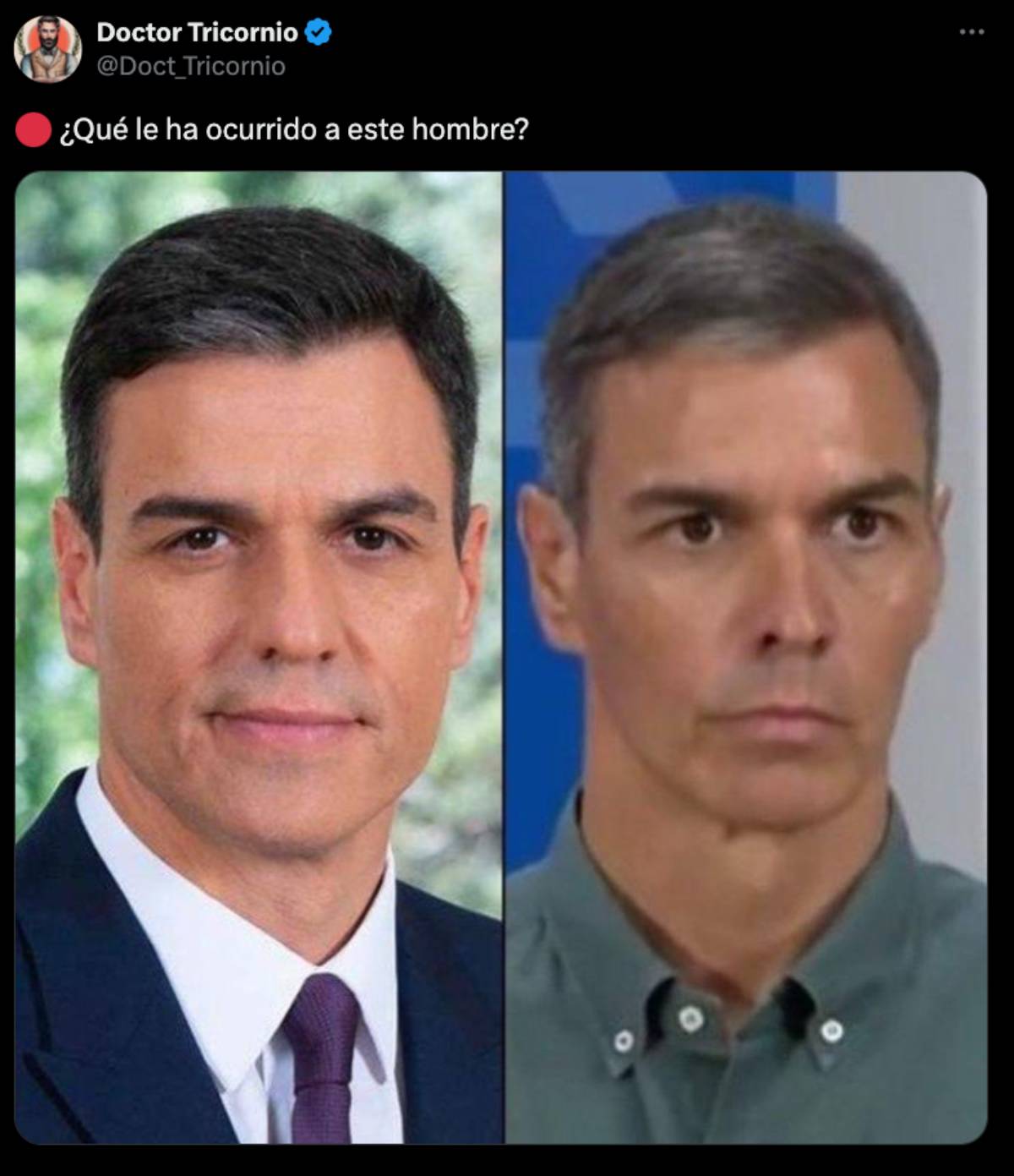 Un tuit muestra un antes y un despu&eacute;s del presidente Pedro S&aacute;nchez. (Redes Sociales)