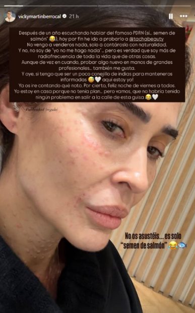 Historia de Instagram de Vicky Mart&iacute;n Berrocal. (Foto: redes sociales)