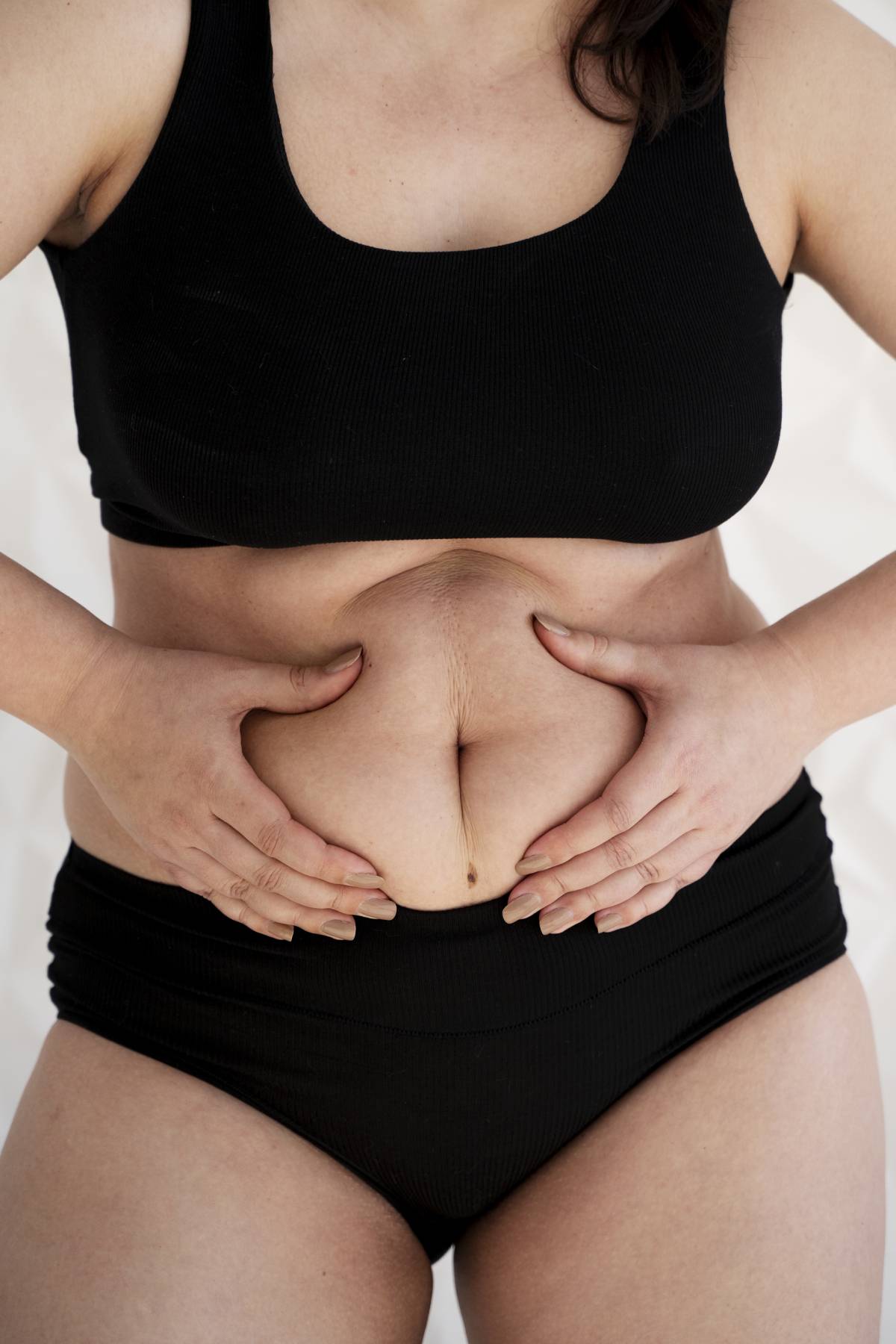 mujer con hinchazón abdominal después de comer sujetando el abdomen