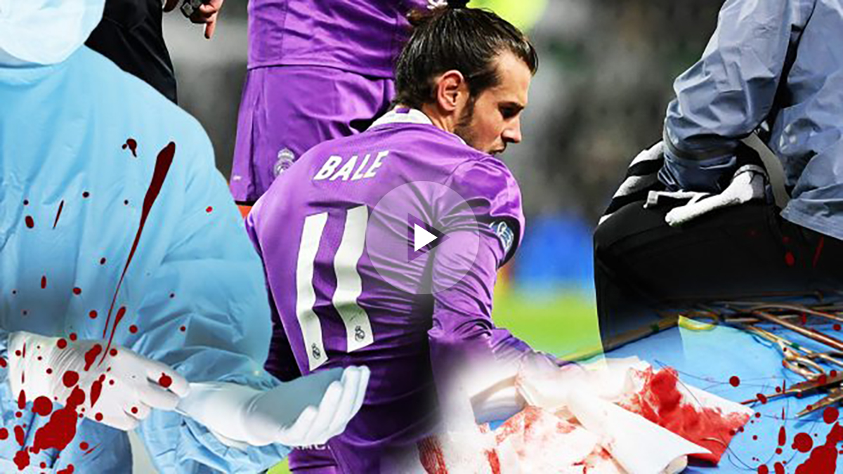 Bale, al quirófano: dice adiós a 2016