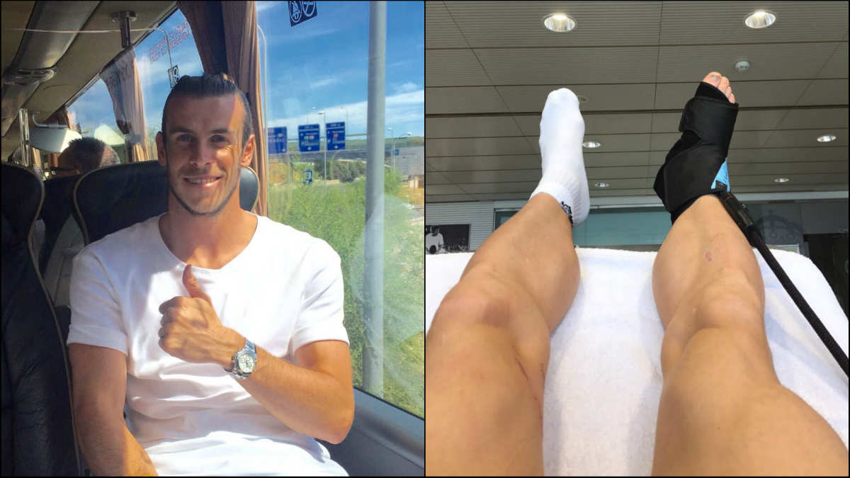 Bale ya trabaja en su recuperación.