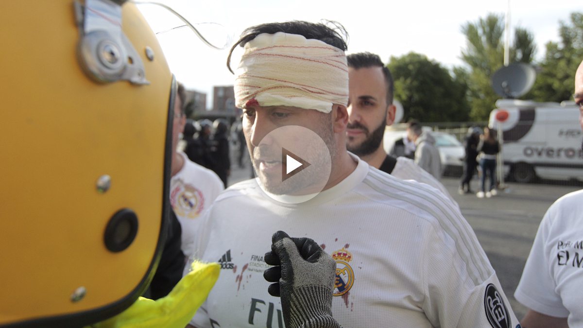 El aficionado madridista, agredido por la afición del Atlético habló con OKDIARIO (Foto: Francisco Toledo)