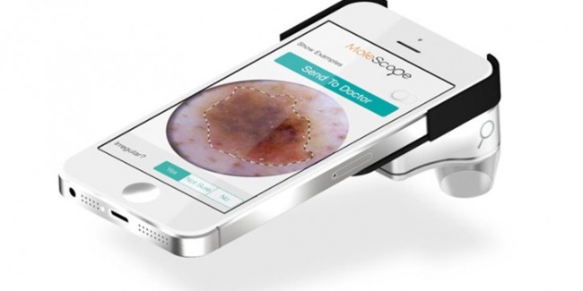 MoleScope, la solución para detectar melanomas