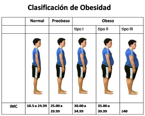 clasificación de obesidad