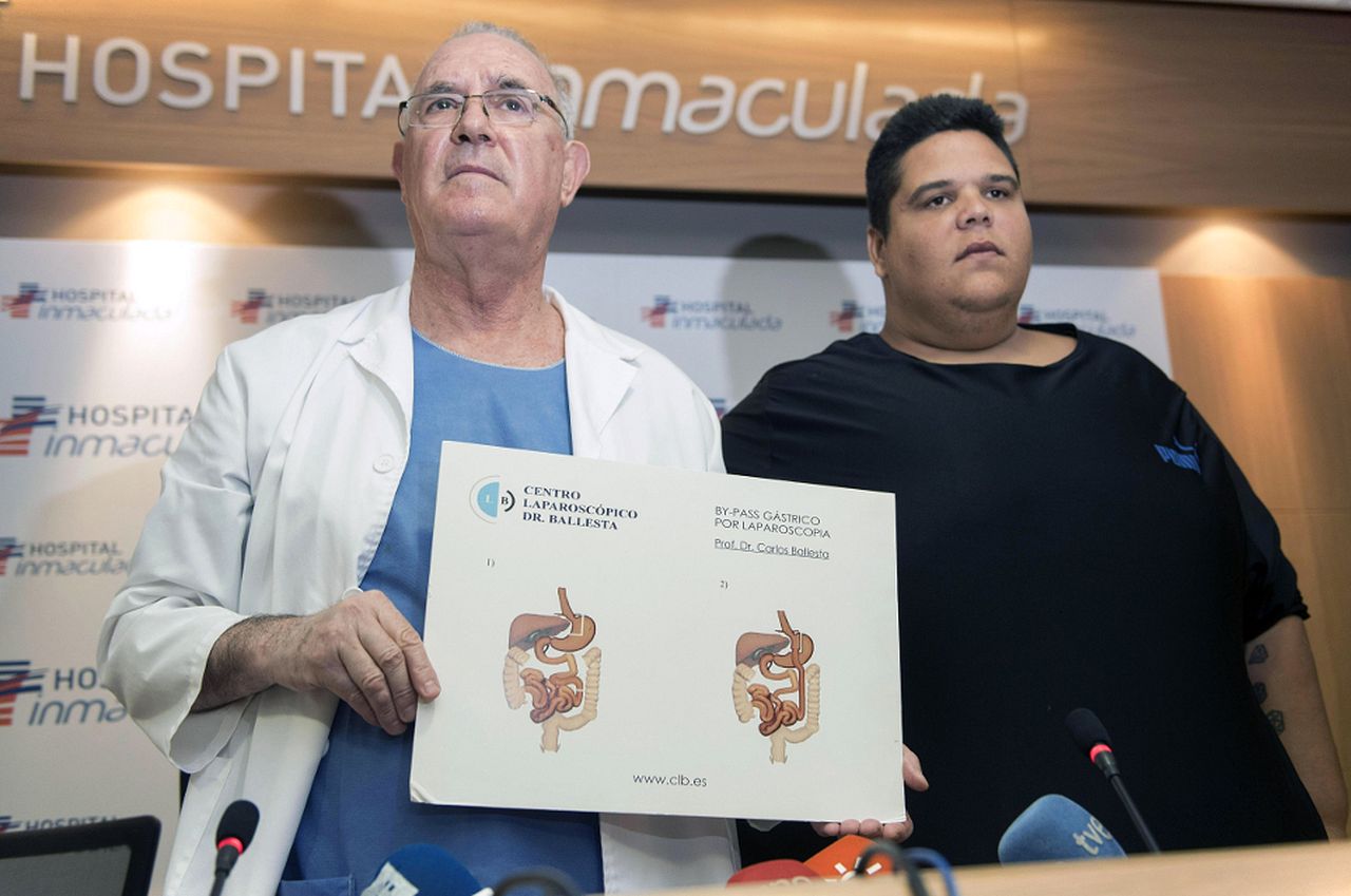 Un baipás gástrico hará perder 200 kilos al hombre más obeso de España