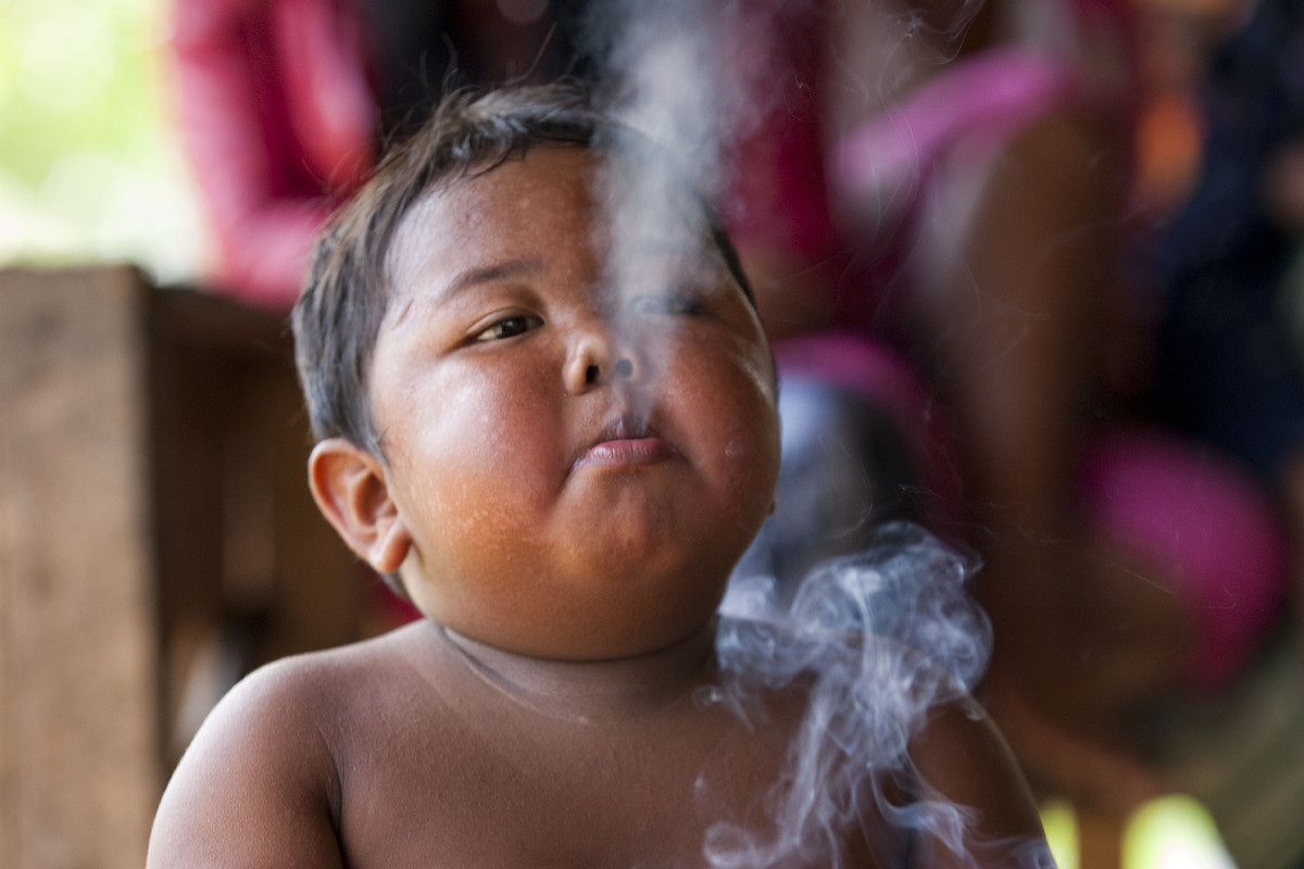 Cómo es ahora la vida del niño que fumaba 40 cigarrillos con 2 años