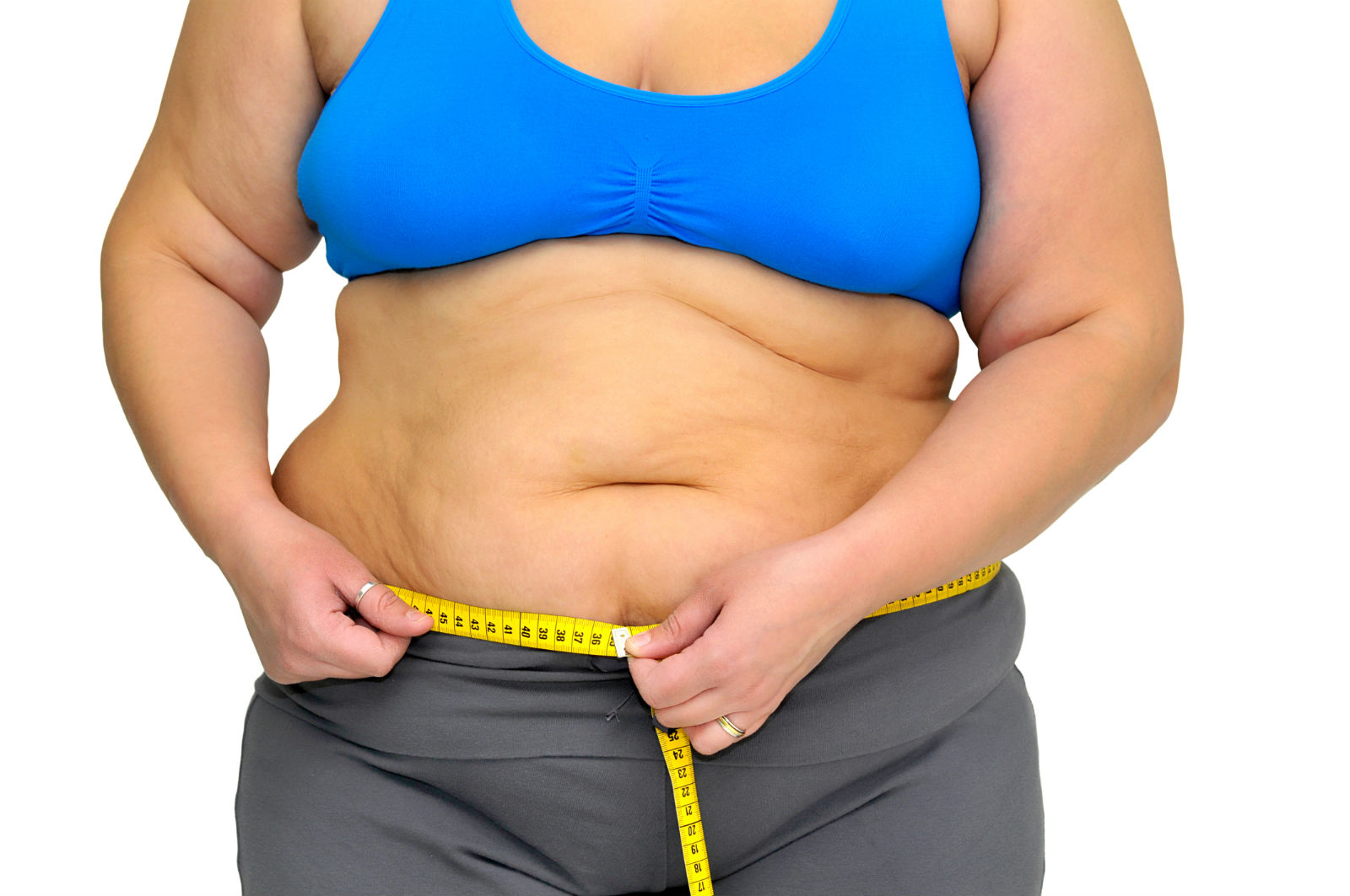 Жир на животе. Ожирение. Лишний вес. Ожирение у женщин. Избыточный вес.