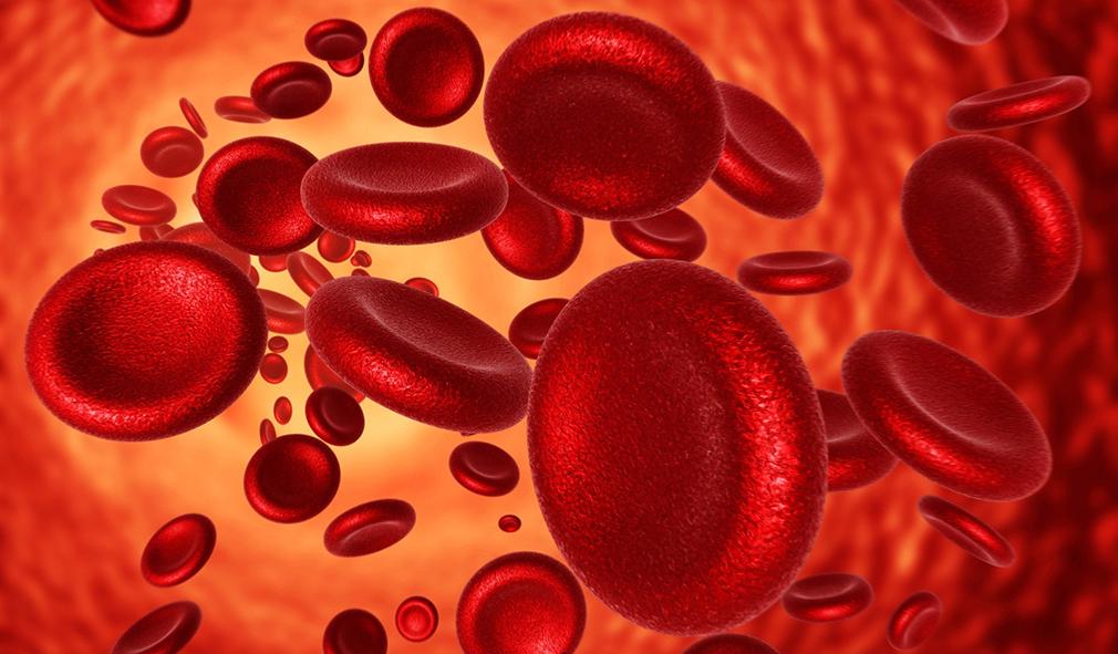 Qué es la anemia ferropénica