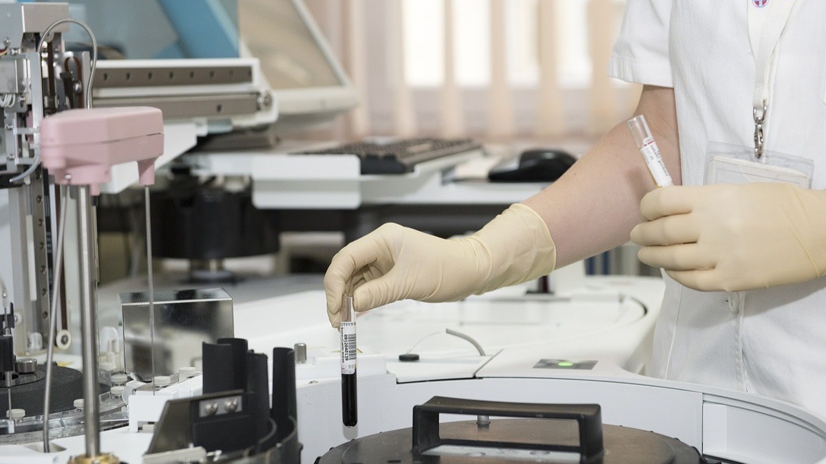 Exceso de proteinas en sangre